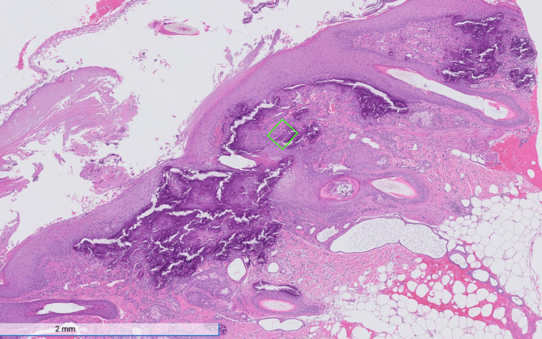 VetDermPath Atlas Quick Take #1: Calcinosis Cutis