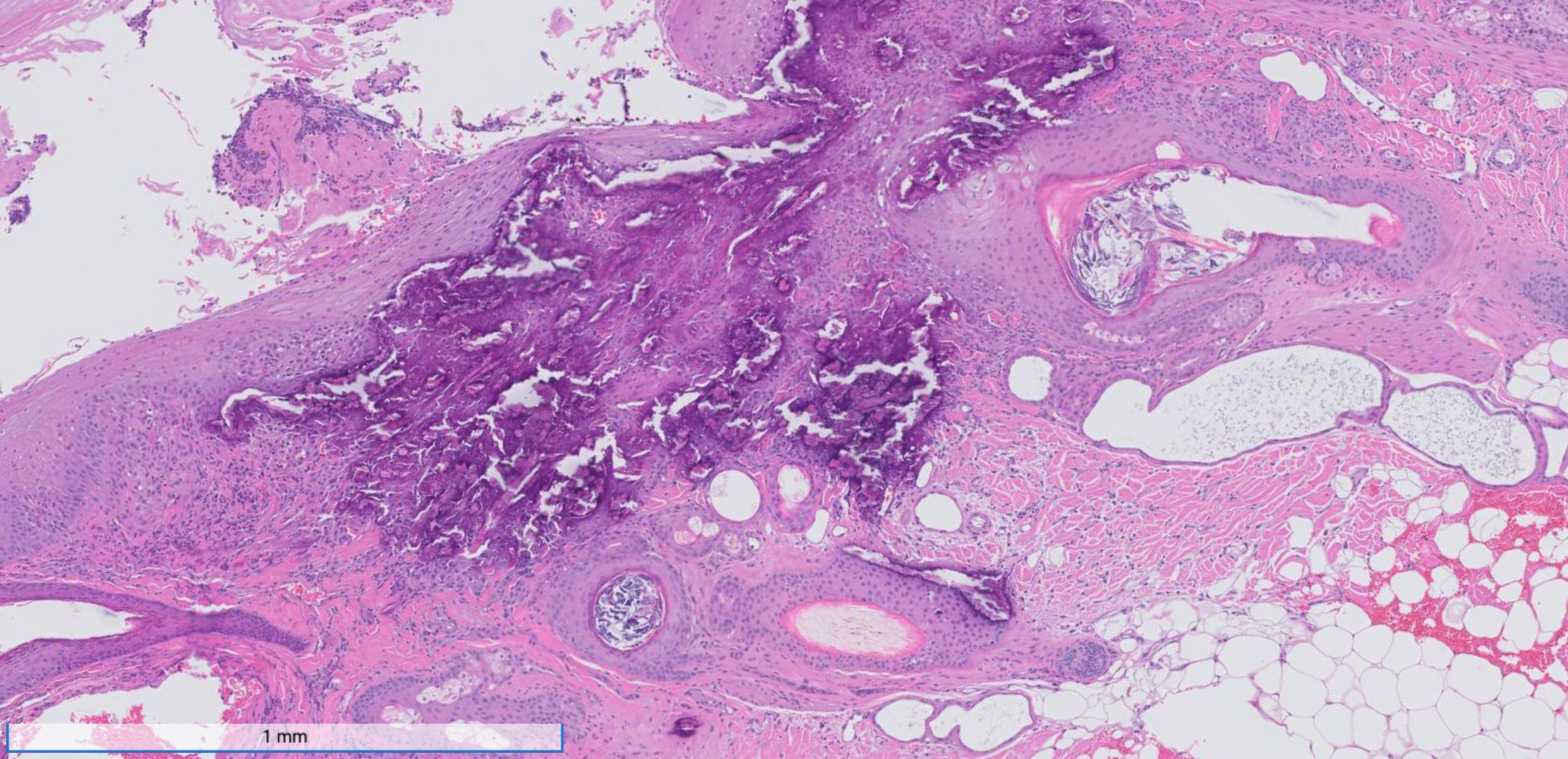 A histopathology image of calcinosis cutis in a dog